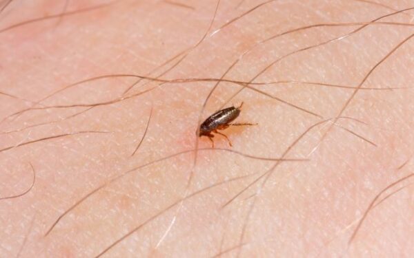 Close-up of flea on human skin